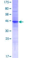 Human LVRN / Laeverin Protein (Recombinant GST, N-terminus)