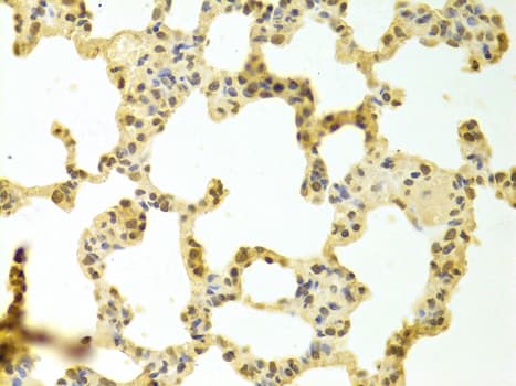 Polyclonal Rabbit anti-Human HNRNPK / hnRNP K Antibody (IHC, IF, WB)