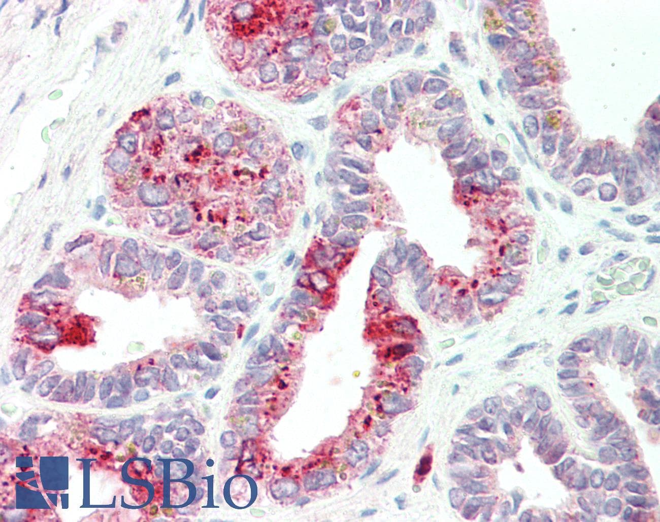 IHC-plus™ Polyclonal Goat anti-Human NAT1 / AAC1 Antibody (aa252-266, IHC, WB)