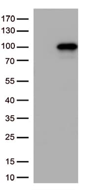 CTNNB1 / Beta Catenin Antibody (clone UMAB14)