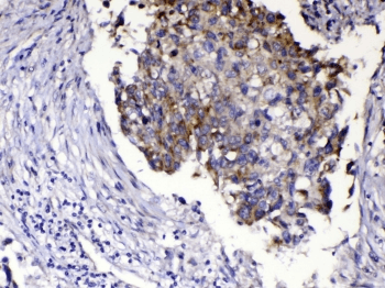 RLN1 / Relaxin Antibody
