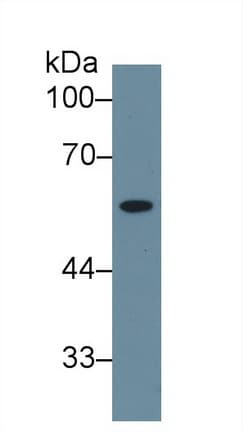 Neuraminidase Antibody (aa47-415)