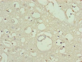 TTLL7 Antibody