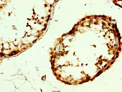 Polyclonal Rabbit anti-Human RAB3GAP2 / p150 Antibody (IHC, WB)