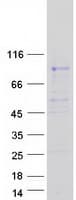 Human PODN Protein (Recombinant Myc-DDK (Flag))