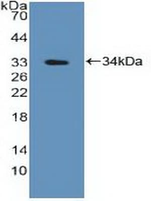 PTPN2 / TC-PTP Antibody