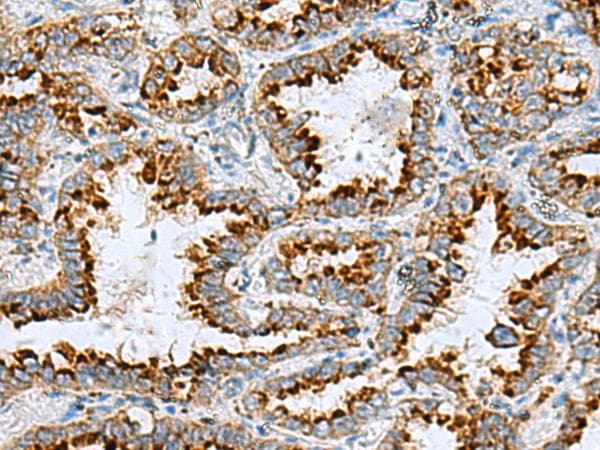 C17orf70 Antibody
