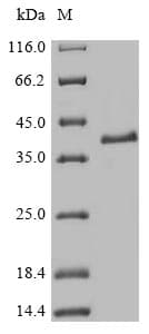 Mouse MAFK Protein (Recombinant 10His-SUMO, N-terminus + Myc, C-terminus)