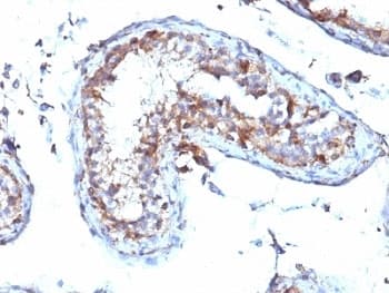 MSN / Moesin Antibody (clone MSN/492)