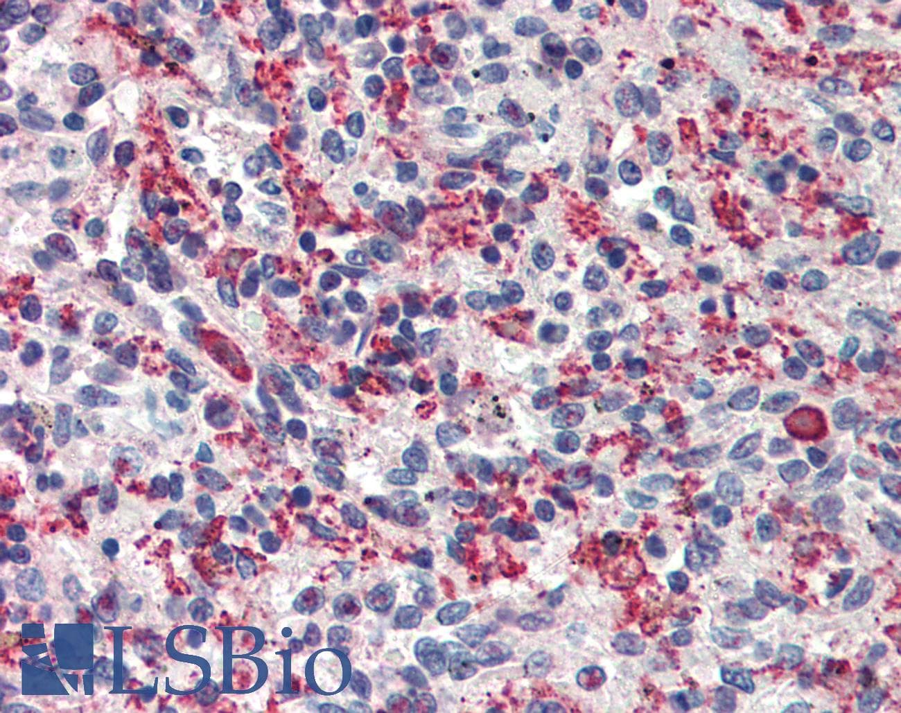 IHC-plus™ CARMA1 / CARD11 Antibody