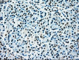 MAP2K4 / MKK4 Antibody (clone OTI1D6)