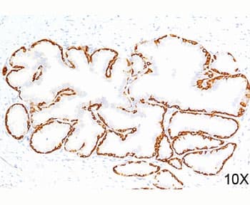 KRT14 / CK14 / Cytokeratin 14 Antibody (C-Terminus, clone LL002, Azide-free, BSA-free)