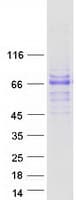 Human Complement C8b Protein (Recombinant Myc-DDK (Flag))