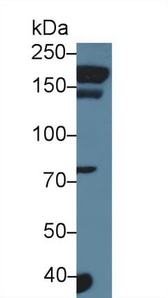 AGRN / Agrin Antibody (aa1206-1475, Cy3)