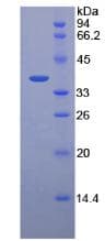 Human PGC / Pepsin C Protein (Recombinant 8His, N-terminus)