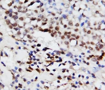 Polyclonal Rabbit anti-Human MAPK3 / ERK1 Antibody (aa287-301, IHC, WB)