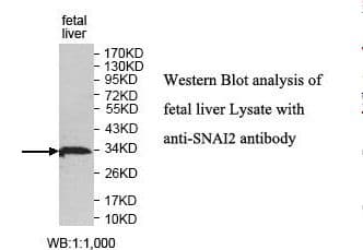 SNAI2 / SLUG Antibody (aa16-199)