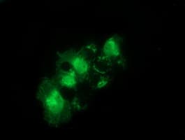 SNTA1 / Syntrophin Alpha 1 Antibody (clone OTI1E9, Carrier-free)