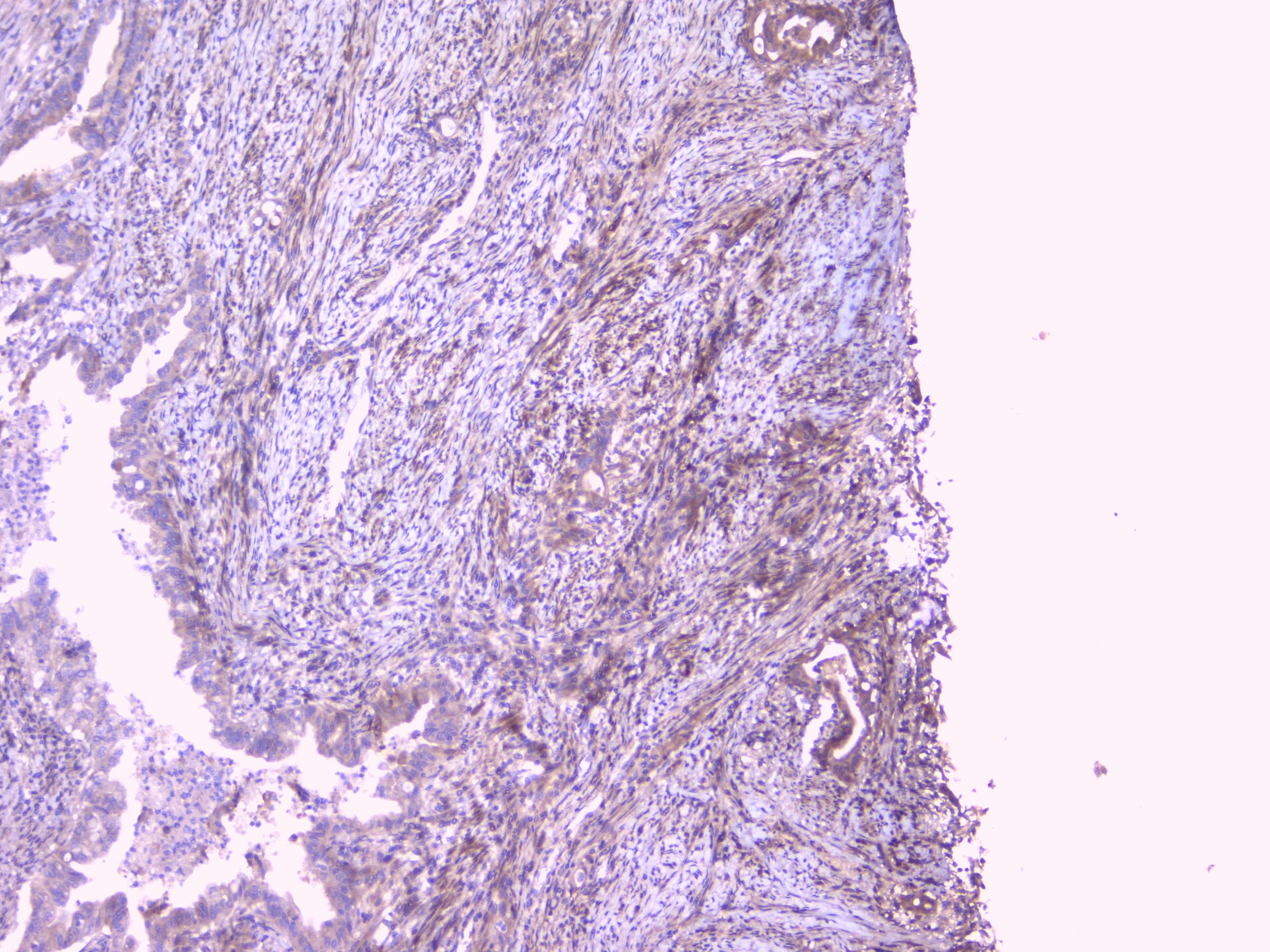 Polyclonal Rabbit anti-Human PEBP1 / RKIP Antibody (WB)