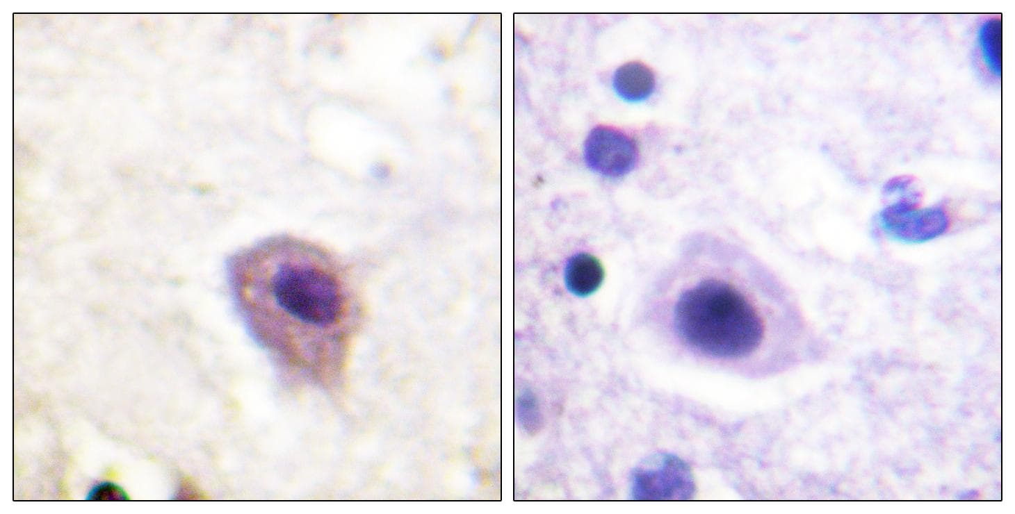 DPYSL2 / CRMP2 Antibody (phospho-Thr514)