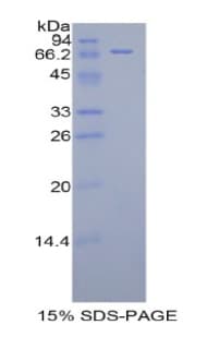 Human KIR3DL3 / CD158z Protein (Recombinant His-GST)