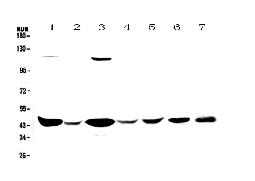 CKB / Creatine Kinase BB Antibody