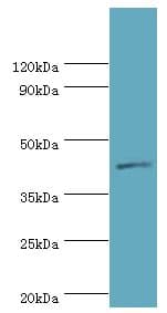 IL13RA2 / IL13R Alpha 2 Antibody (aa27-343)