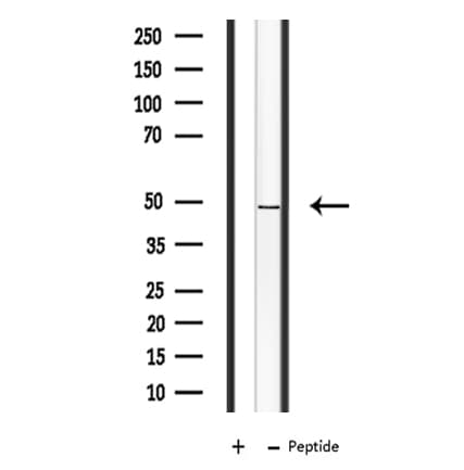 PRPF19 / PRP19 Antibody