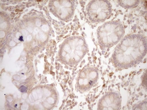 Monoclonal Mouse anti-Human CSF1 / MCSF Antibody (clone OTI8E1, aa223-496, IHC, WB)