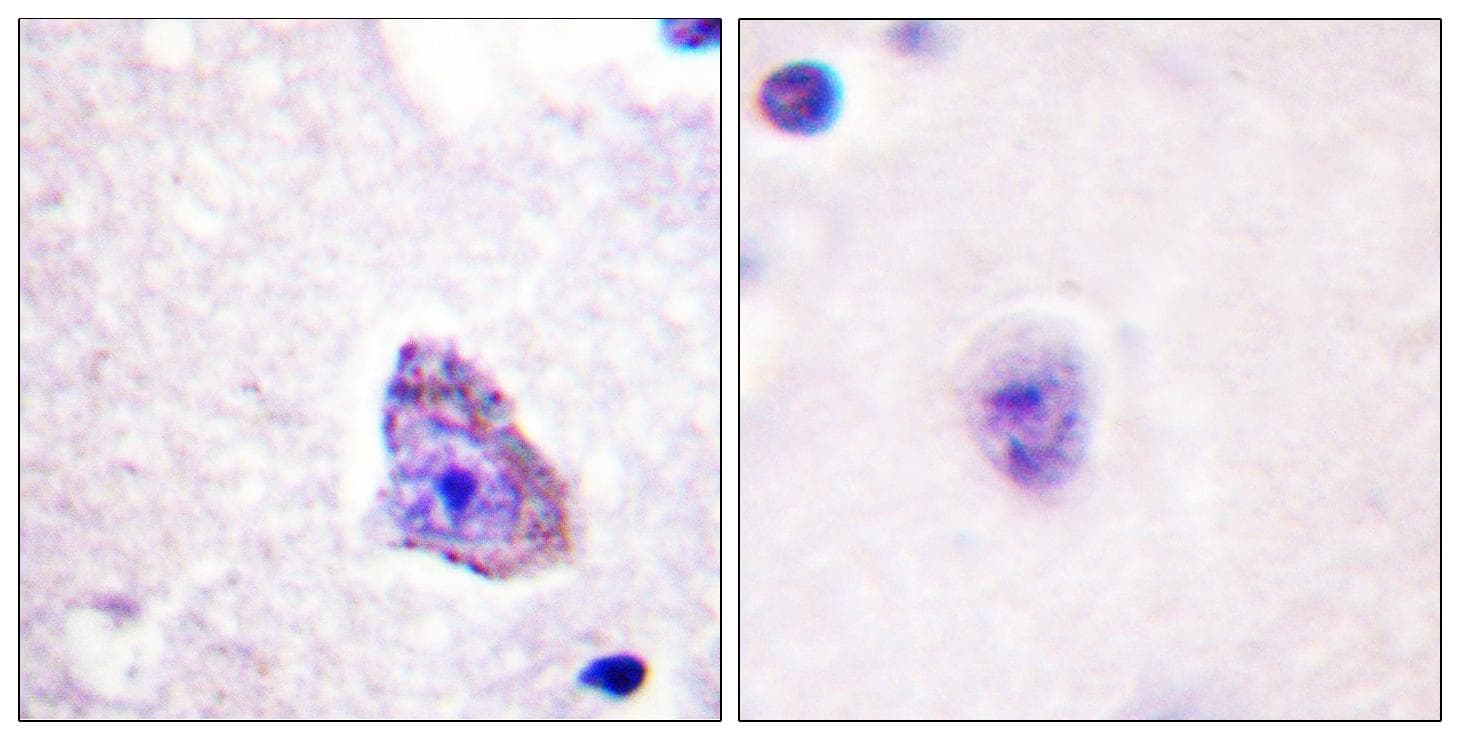 Polyclonal Rabbit anti-Human RPS6KB1 / P70S6K / S6K Antibody (phospho-Thr229, IHC, WB)