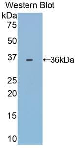 Transferrin / Transferrin Receptor Antibody (PE)