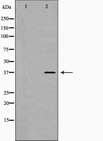 Polyclonal Rabbit anti-Human Lumican Antibody (IHC, WB)