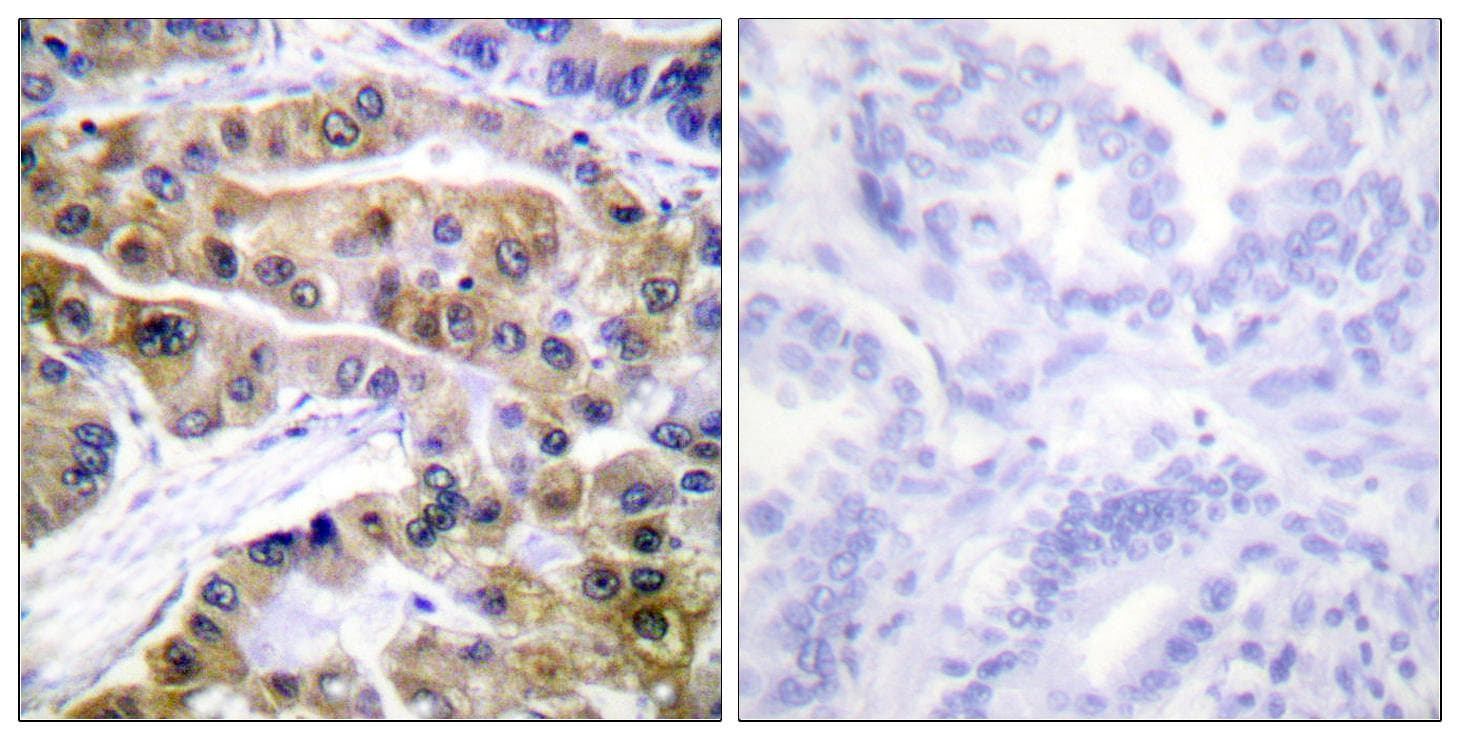 Polyclonal Rabbit anti-Human ATP1A1 Antibody (phospho-Ser16, IHC, WB)