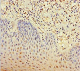 CLEC4D / MCL Antibody (aa39-215)
