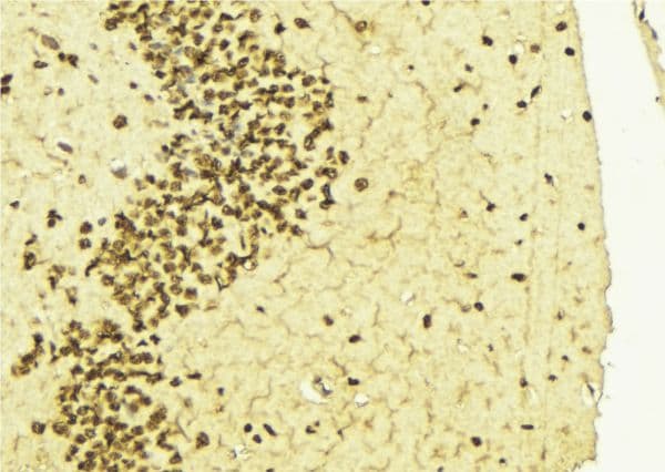 HNRNPD / AUF1 Antibody (phospho-Ser83)