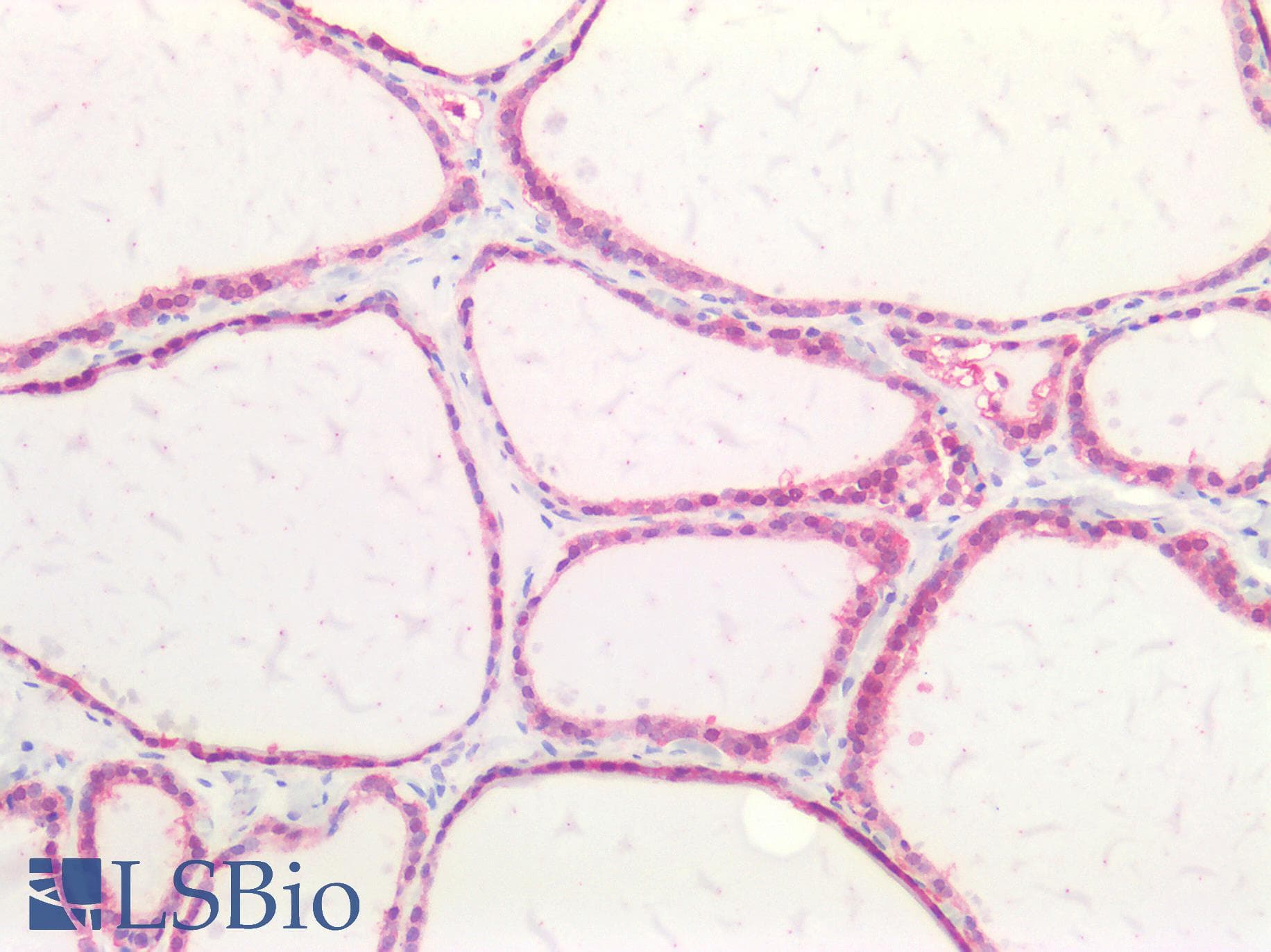 IHC-plus™ BMP2 Antibody