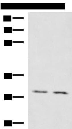 KRCC1 Antibody