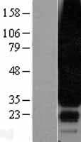 Human SIPR3 / EDG3 / S1P3 Protein (Over-Expression Lysate Myc-DDK (Flag))