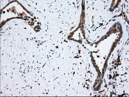 Monoclonal Mouse anti-Human TS / Thromboxane Synthase Antibody (clone OTI1H1, IHC, IF, WB)