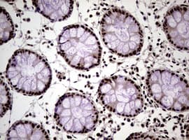 Monoclonal Mouse anti-Human NBN / Nibrin Antibody (clone OTI8E7, IHC, WB)