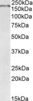 IHC-plus™ Polyclonal Goat anti-Mouse ROBO1 Antibody (aa1417-1428, IHC, WB)