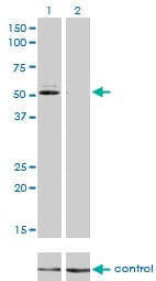 GSR / Glutathione Reductase Antibody (clone 6B4)