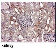SLC17A9 / C20orf59 Antibody