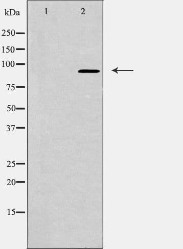 Polyclonal Rabbit anti-Human NUP93 Antibody (WB)