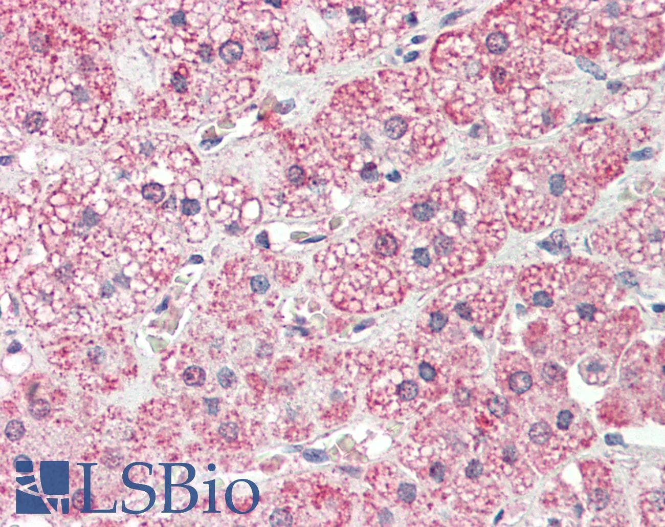 Polyclonal Rabbit anti-Human PLOD2 Antibody (aa467-516, IHC, WB)