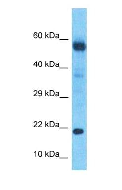 DBNDD2 Antibody (Internal)