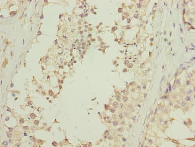 Polyclonal Rabbit anti-Human DNALI1 Antibody (IHC, WB)