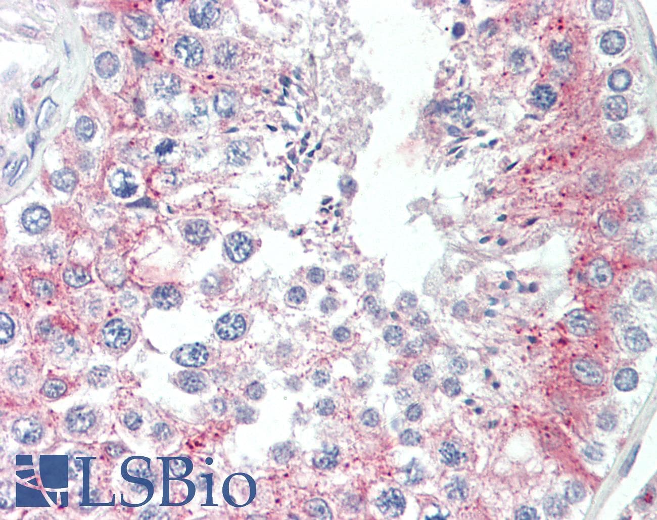 IHC-plus™ TCTE3 Antibody