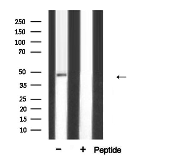TFAP2A / AP-2 Antibody