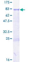 Human RNMTL1 Protein (Recombinant GST)